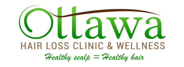 Ottawa Hair Loss Clinic